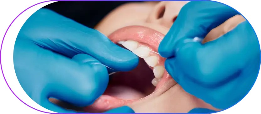 Soft Tissue Grafting in Kolkata